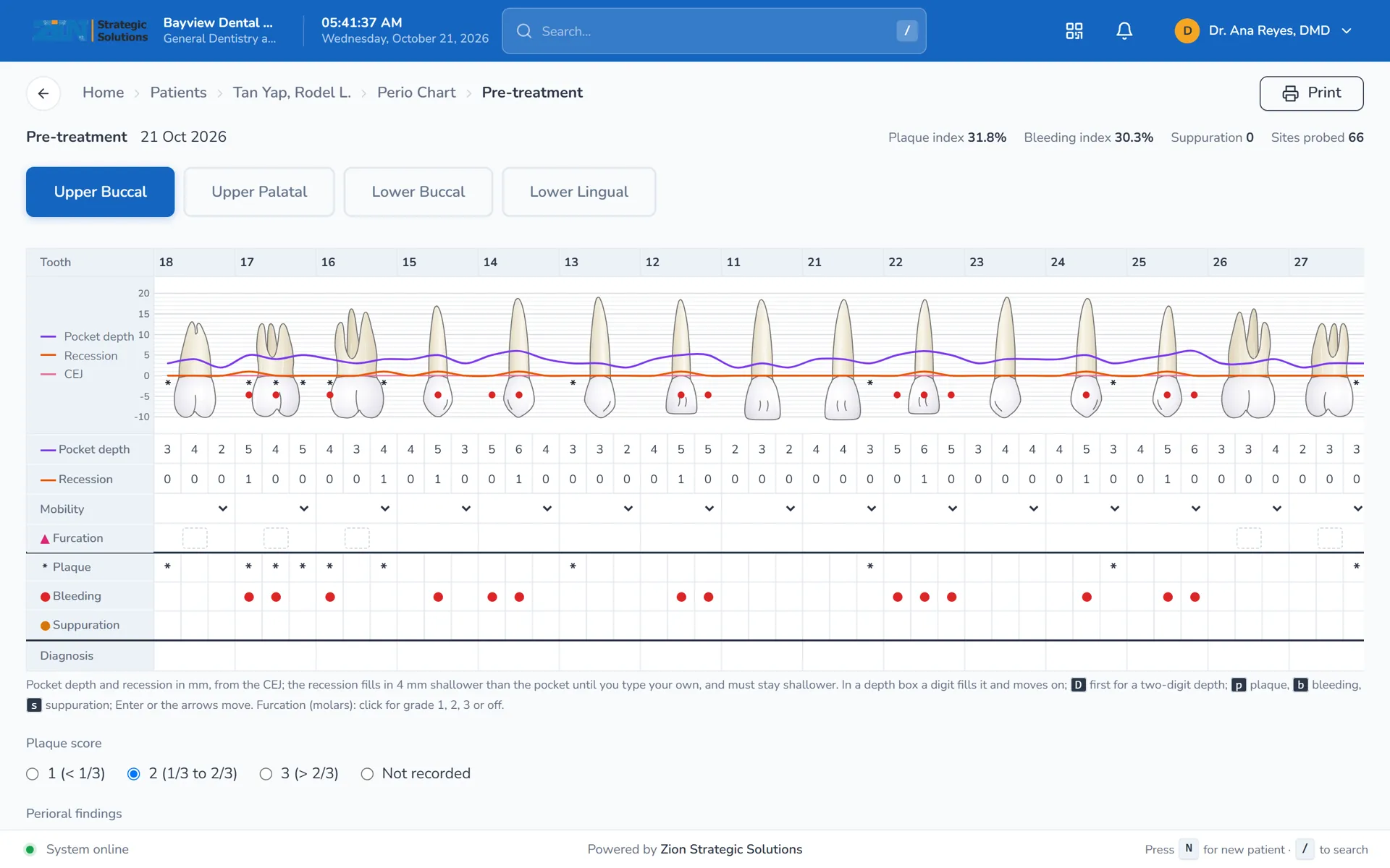 Periodontal chart with pocket depth graph above the site boxes